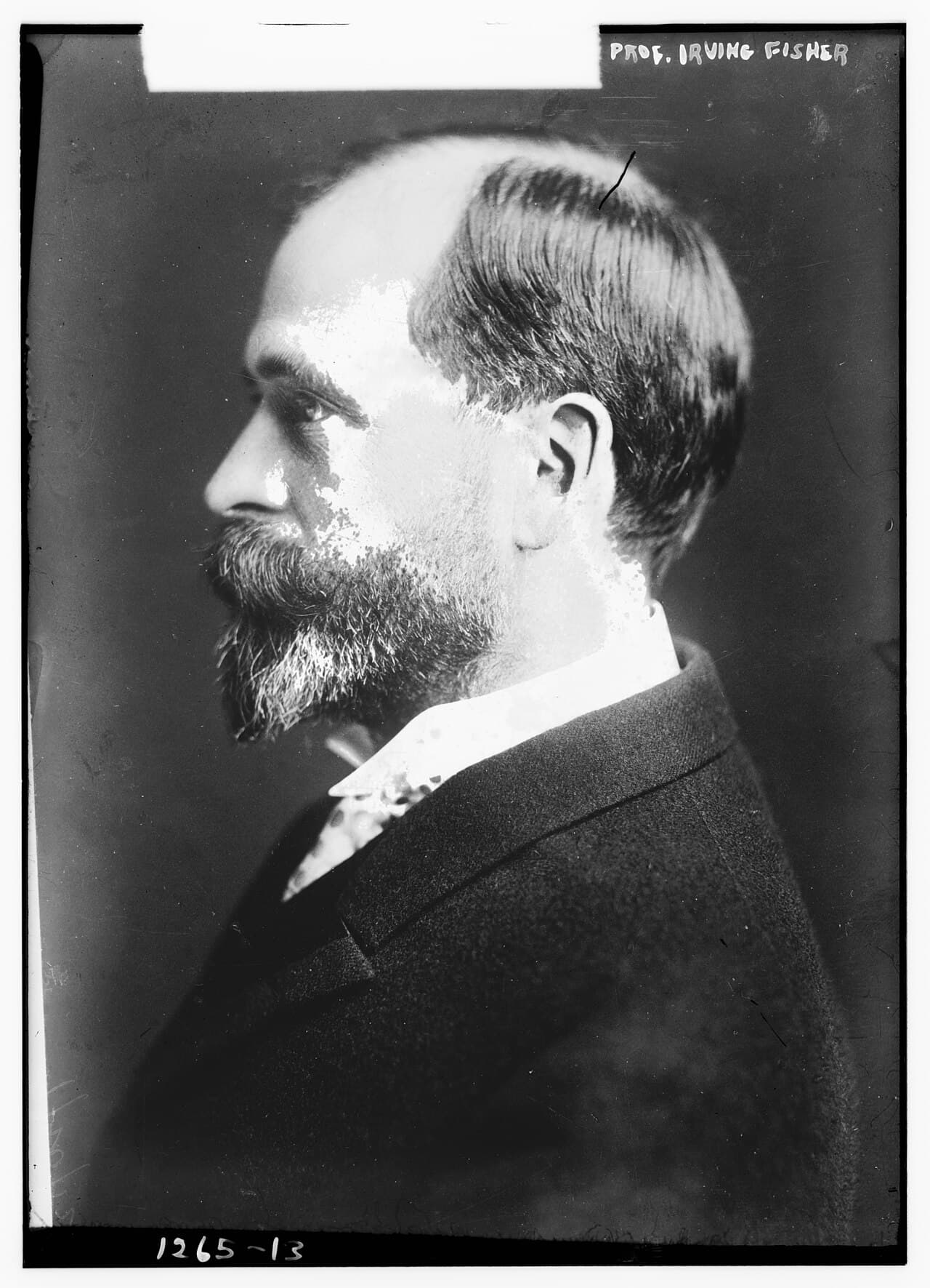Black-and-white glass-plate photograph of the economist Irving Fisher, a bearded man in a suit.